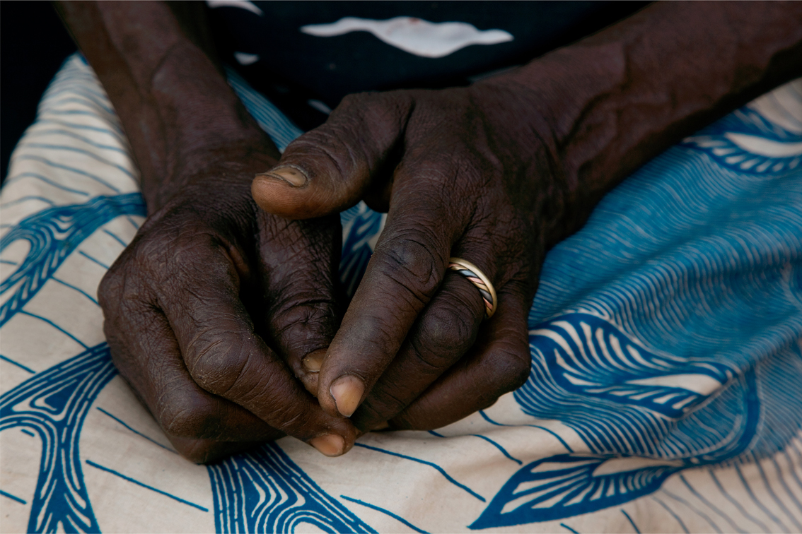 Frauenhände, denen man harte Arbeit ansieht, mit einem Ring am linken Mittelfinger  auf einem blau-weißen Tuch